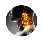 Cervical Spine Surgery