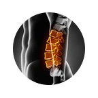 lumbar-spine-surgery-xray