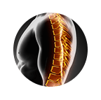 Thoracic Spine Surgery Xray