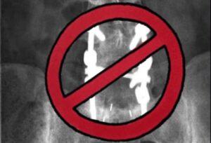 recovery from spinal fusion surgery