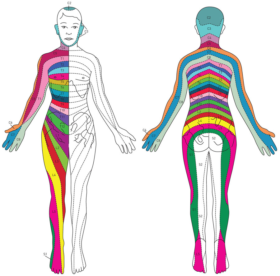 Spinal Nerve Pain Chart