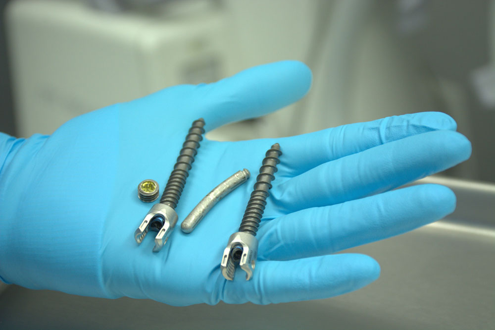 Screws-in-hand Spinal fusion hardware removal