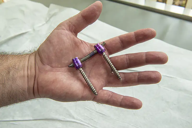 Fusion Hand