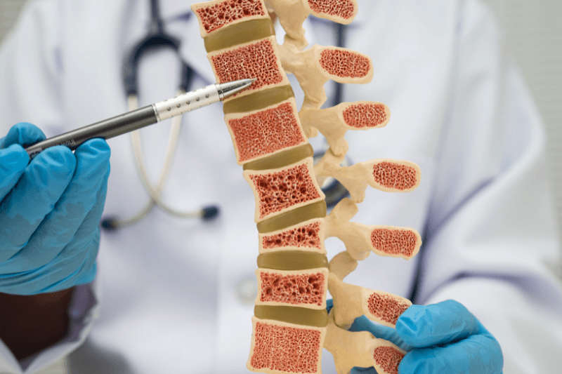 SpinalFusionBody