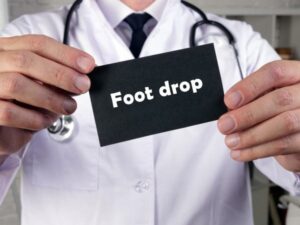 Foot Drop Caused by Pinched Nerve