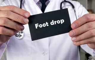 Foot Drop Caused by Pinched Nerve