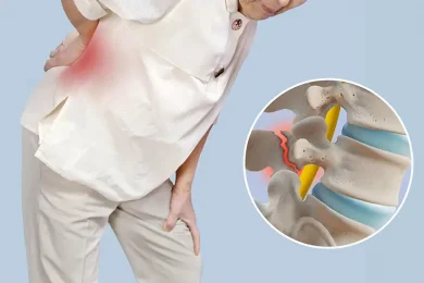 Spondylolisthesis_hero